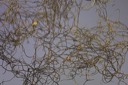 1411 Usnea chalybeiformis-Bryoria fusceascens